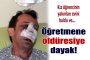 ogretmene-olduresiye-dayak-2240363.jpg